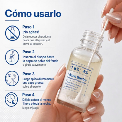 Maleva™ Tratamiento Secante para Acné